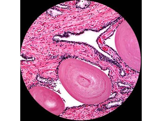 40X-2000X LED Monocular Compound Microscope with Mechanical Stage and Digital Camera D87945